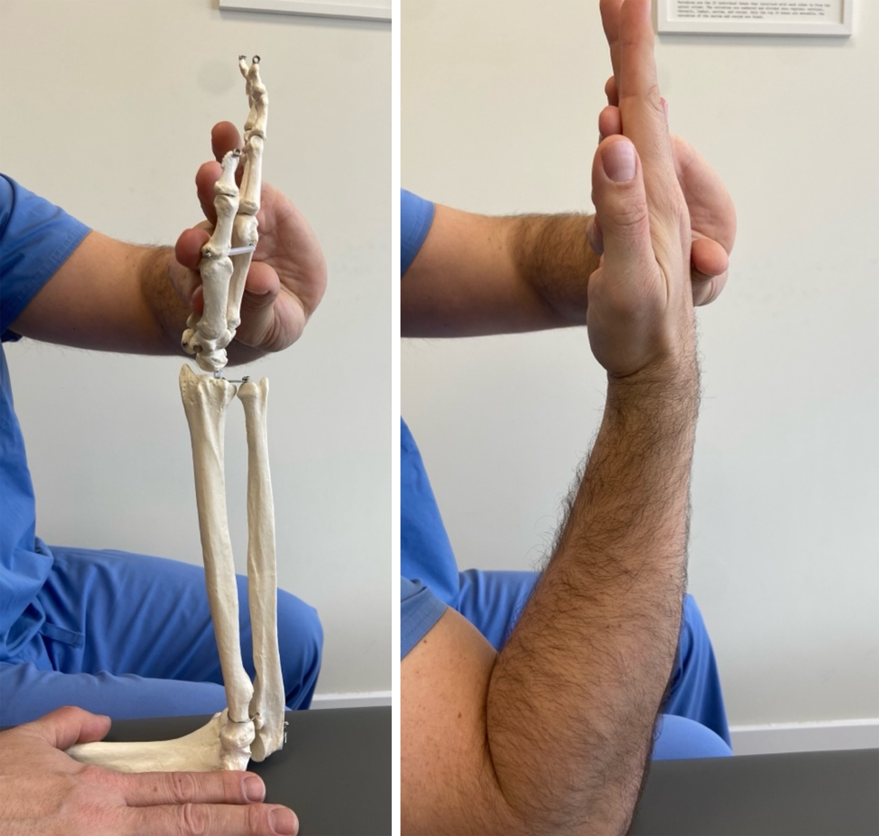 1-Estiramiento-de-los-músculos-flexores-de-la-muñeca 1-Estiramiento-de-los-músculos-flexores-de-la-muñeca