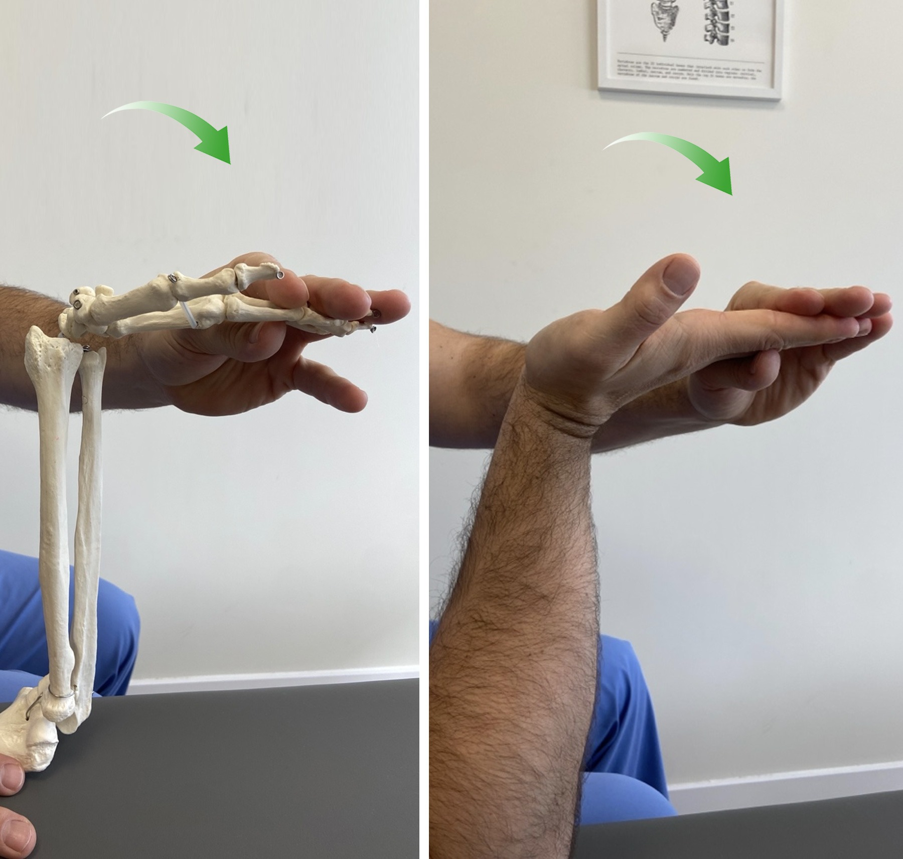 2-Estiramiento-de-los-flexores-de-los-dedos