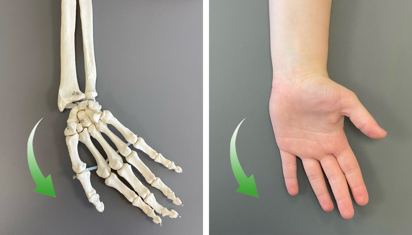 fotos-2-Desviaciones-laterales-1